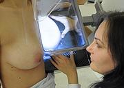 Mammografische Untersuchung