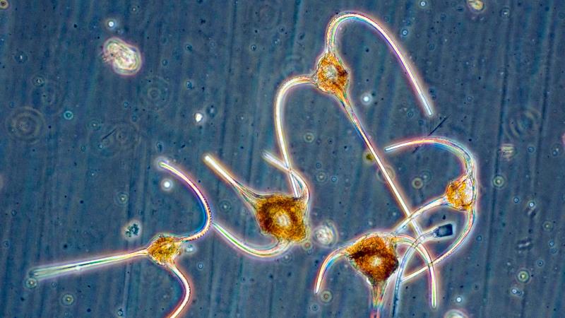 Mikroskopische Aufnahme von Dinoflagellaten der Gattung Ceratium